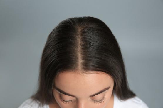 PRP cheveux