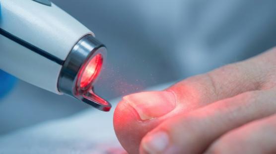 Traitement ongles 
